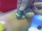 Controlar el colesterol en caso de diabetes tipo 2