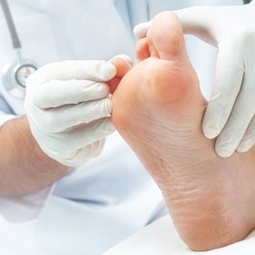 Síntomas y tratamiento del pie diabético